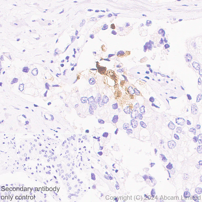 Immunohistochemistry (Formalin/PFA-fixed paraffin-embedded sections) - Anti-CXCL11 antibody [EPR27375-62] - BSA and Azide free (AB326599)