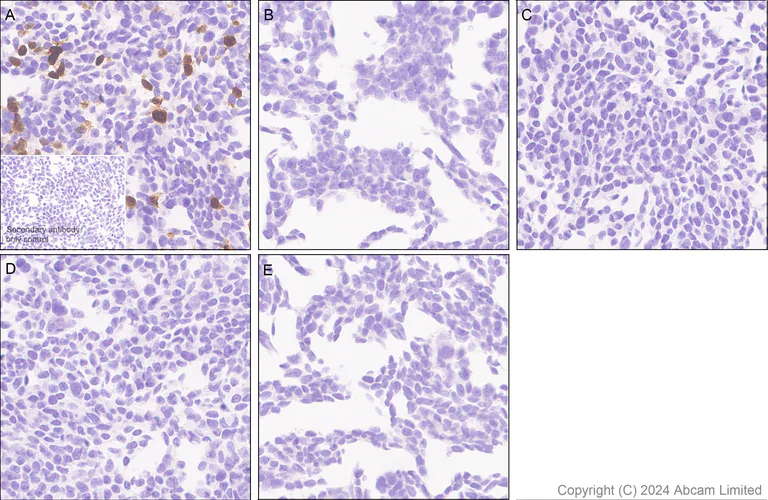 Immunohistochemistry (Formalin/PFA-fixed paraffin-embedded sections) - Anti-CXCL11 antibody [EPR27375-62] - BSA and Azide free (AB326599)
