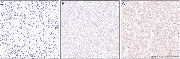 Immunohistochemistry (Formalin/PFA-fixed paraffin-embedded sections) - Anti-CXCL11 antibody [EPR27375-62] - BSA and Azide free (AB326599)