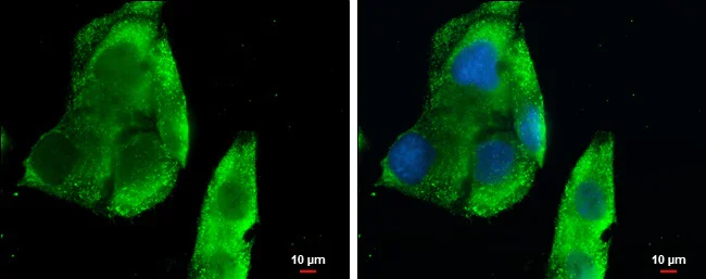 Immunocytochemistry/ Immunofluorescence - Anti-CXCL13 antibody (AB272874)