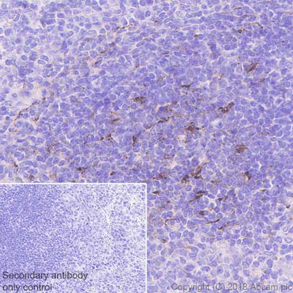 Immunohistochemistry (Formalin/PFA-fixed paraffin-embedded sections) - Anti-CXCL13 antibody [EPR19259-147] (AB199043), expandable thumbnail