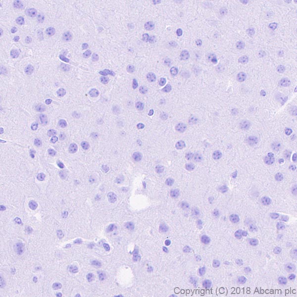 Immunohistochemistry (Formalin/PFA-fixed paraffin-embedded sections) - Anti-CXCL13 antibody [EPR19259-147] - BSA and Azide free (AB251265)