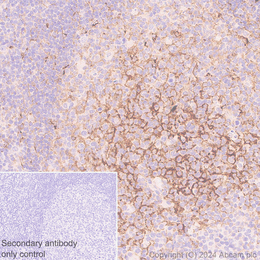 B58-113 CLINICAL SYMPOSIA SELECTED EDITION Ⅰ シミ汚れあり