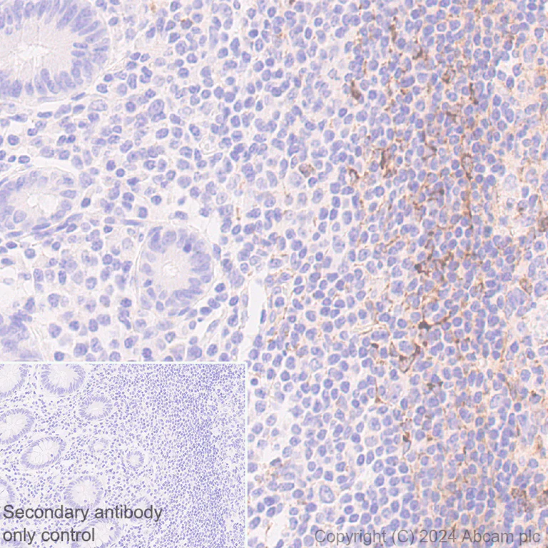 Immunohistochemistry (Formalin/PFA-fixed paraffin-embedded sections) - Anti-CXCL13 antibody [RM1170] (AB317508)