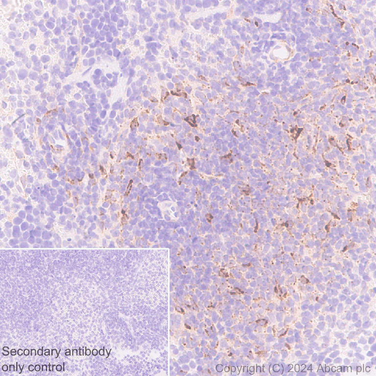 Immunohistochemistry (Formalin/PFA-fixed paraffin-embedded sections) - Anti-CXCL13 antibody [RM1170] (AB317508)