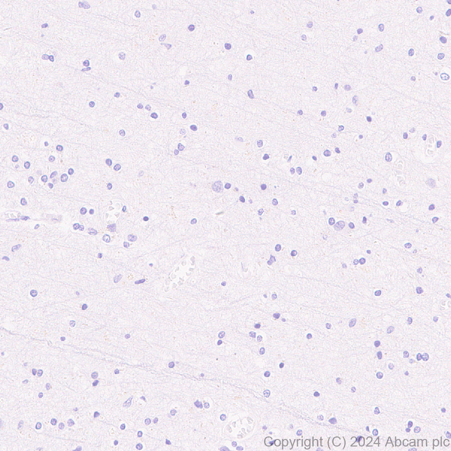 Immunohistochemistry (Formalin/PFA-fixed paraffin-embedded sections) - Anti-CXCL13 antibody [RM1170] (AB317508)