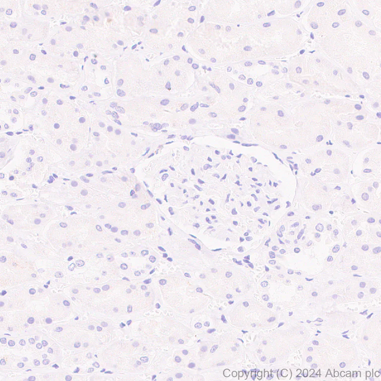 Immunohistochemistry (Formalin/PFA-fixed paraffin-embedded sections) - Anti-CXCL13 antibody [RM1170] (AB317508)