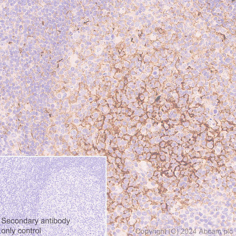 Immunohistochemistry (Formalin/PFA-fixed paraffin-embedded sections) - Anti-CXCL13 antibody [RM1170] - BSA and Azide free (AB317509)