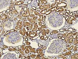 Immunohistochemistry (Formalin/PFA-fixed paraffin-embedded sections) - Anti-CXCL14 antibody (AB137541)