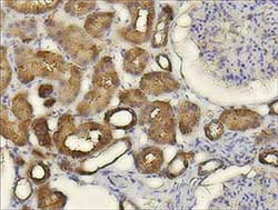 Immunohistochemistry (Formalin/PFA-fixed paraffin-embedded sections) - Anti-CXCL14 antibody (AB137541)