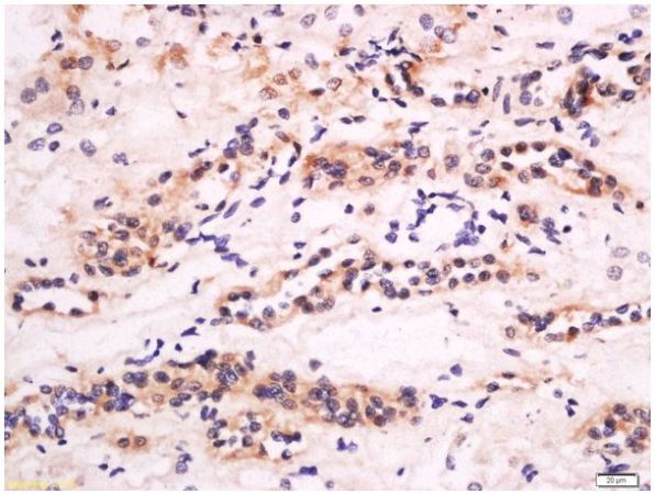 Immunohistochemistry (Formalin/PFA-fixed paraffin-embedded sections) - Anti-CXCL14 antibody (AB217307), expandable thumbnail