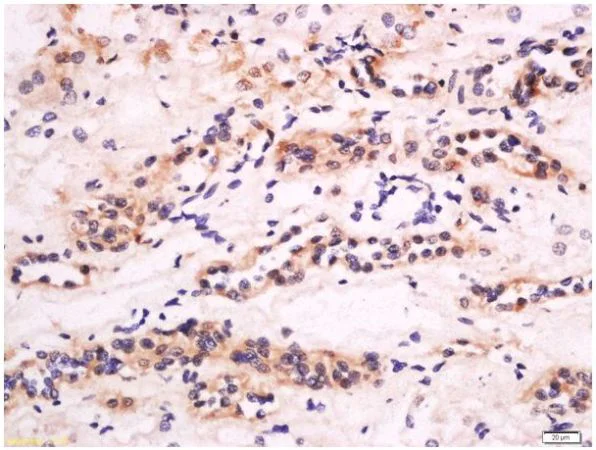 Immunohistochemistry (Formalin/PFA-fixed paraffin-embedded sections) - Anti-CXCL14 antibody (AB217307)