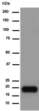 Western blot - Anti-CXCL15 antibody [EPR14469] (AB183705), expandable thumbnail