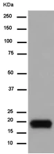 Western blot - Anti-CXCL15 antibody [EPR14469] (AB183705)