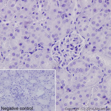 Immunohistochemistry (Formalin/PFA-fixed paraffin-embedded sections) - Anti-CXCL15 antibody [EPR14470] (AB197016), expandable thumbnail