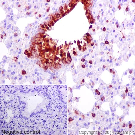 Immunohistochemistry (Formalin/PFA-fixed paraffin-embedded sections) - Anti-CXCL15 antibody [EPR14470] (AB197016), expandable thumbnail