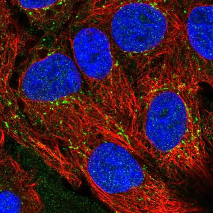 Immunocytochemistry/ Immunofluorescence - Anti-CXCL16 antibody (AB220616)