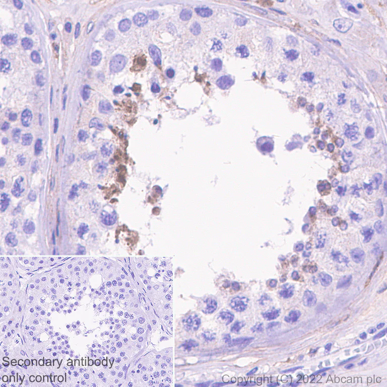 Immunohistochemistry - Anti-CXCL16 antibody [EPR25370-42] (AB307694)