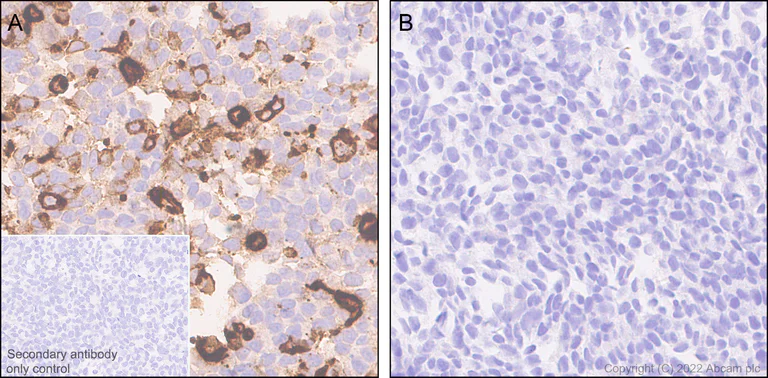 Immunohistochemistry - Anti-CXCL16 antibody [EPR25370-42] (AB307694)
