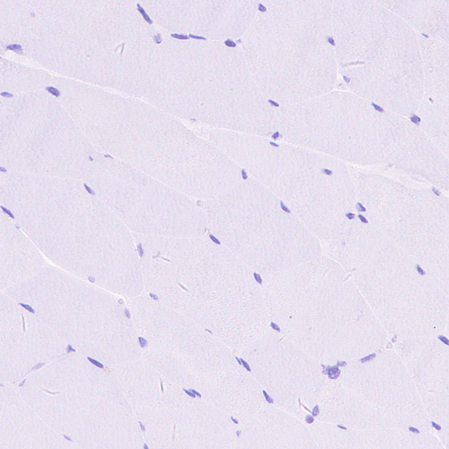 Immunohistochemistry - Anti-CXCL16 antibody [EPR25370-42] - BSA and Azide free (ab307695), expandable thumbnail