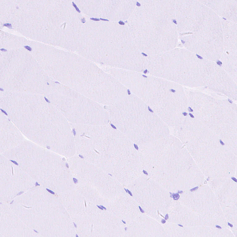 Immunohistochemistry - Anti-CXCL16 antibody [EPR25370-42] - BSA and Azide free (AB307695)