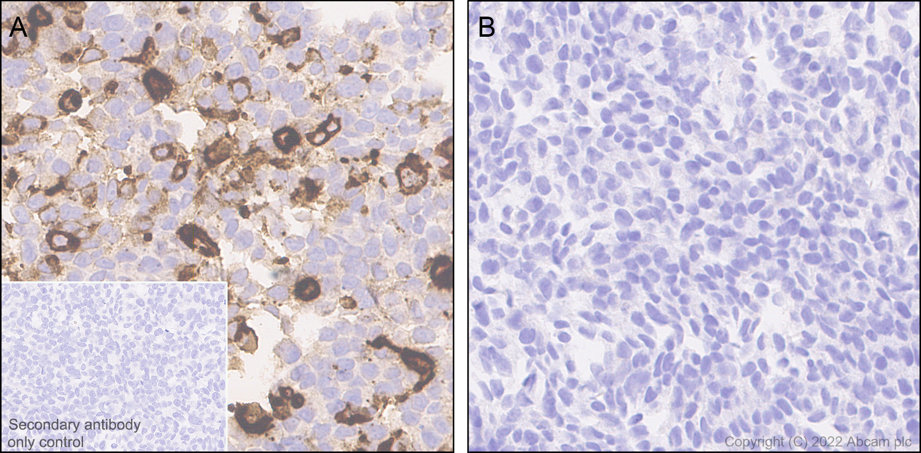 Immunohistochemistry - Anti-CXCL16 antibody [EPR25370-42] - BSA and Azide free (AB307695), expandable thumbnail