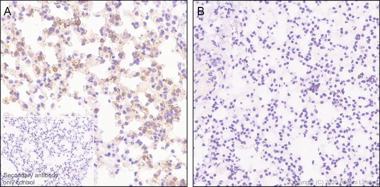 Immunohistochemistry (Formalin/PFA-fixed paraffin-embedded sections) - Anti-CXCL16 antibody [EPR29714-545] (AB324591)