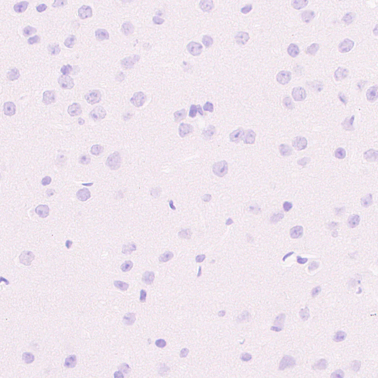 Immunohistochemistry (Formalin/PFA-fixed paraffin-embedded sections) - Anti-CXCL16 antibody [EPR29714-545] (AB324591)