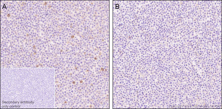 Immunohistochemistry (Formalin/PFA-fixed paraffin-embedded sections) - Anti-CXCL16 antibody [EPR29714-545] (AB324591)