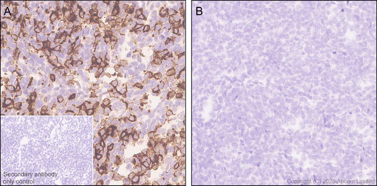 Immunohistochemistry (Formalin/PFA-fixed paraffin-embedded sections) - Anti-CXCL16 antibody [EPR29714-545] (AB324591)