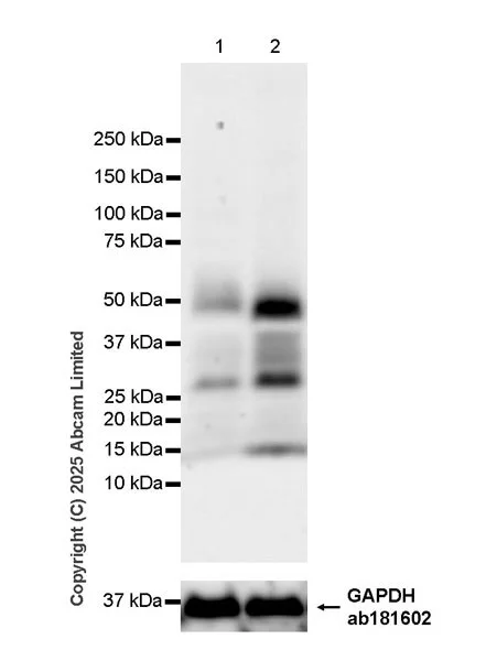 Western blot - Anti-CXCL16 antibody [EPR29714-545] (AB324591)