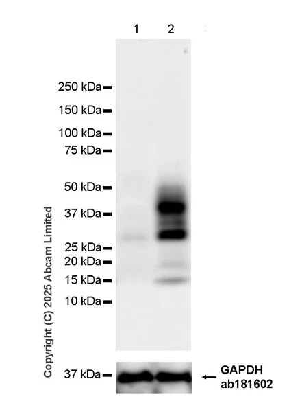 Western blot - Anti-CXCL16 antibody [EPR29714-545] (AB324591)