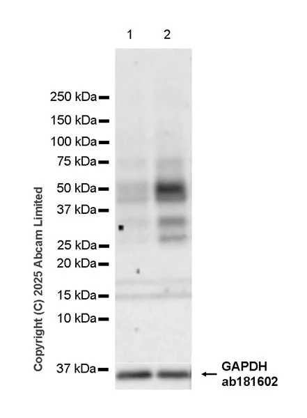 Western blot - Anti-CXCL16 antibody [EPR29714-545] (AB324591)