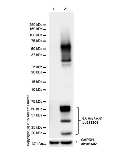 Western blot - Anti-CXCL16 antibody [EPR29714-545] (AB324591)