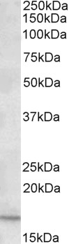 Western blot - Anti-CXCL2 antibody (AB91511), expandable thumbnail