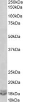 Western blot - Anti-CXCL2 antibody (AB91511), expandable thumbnail