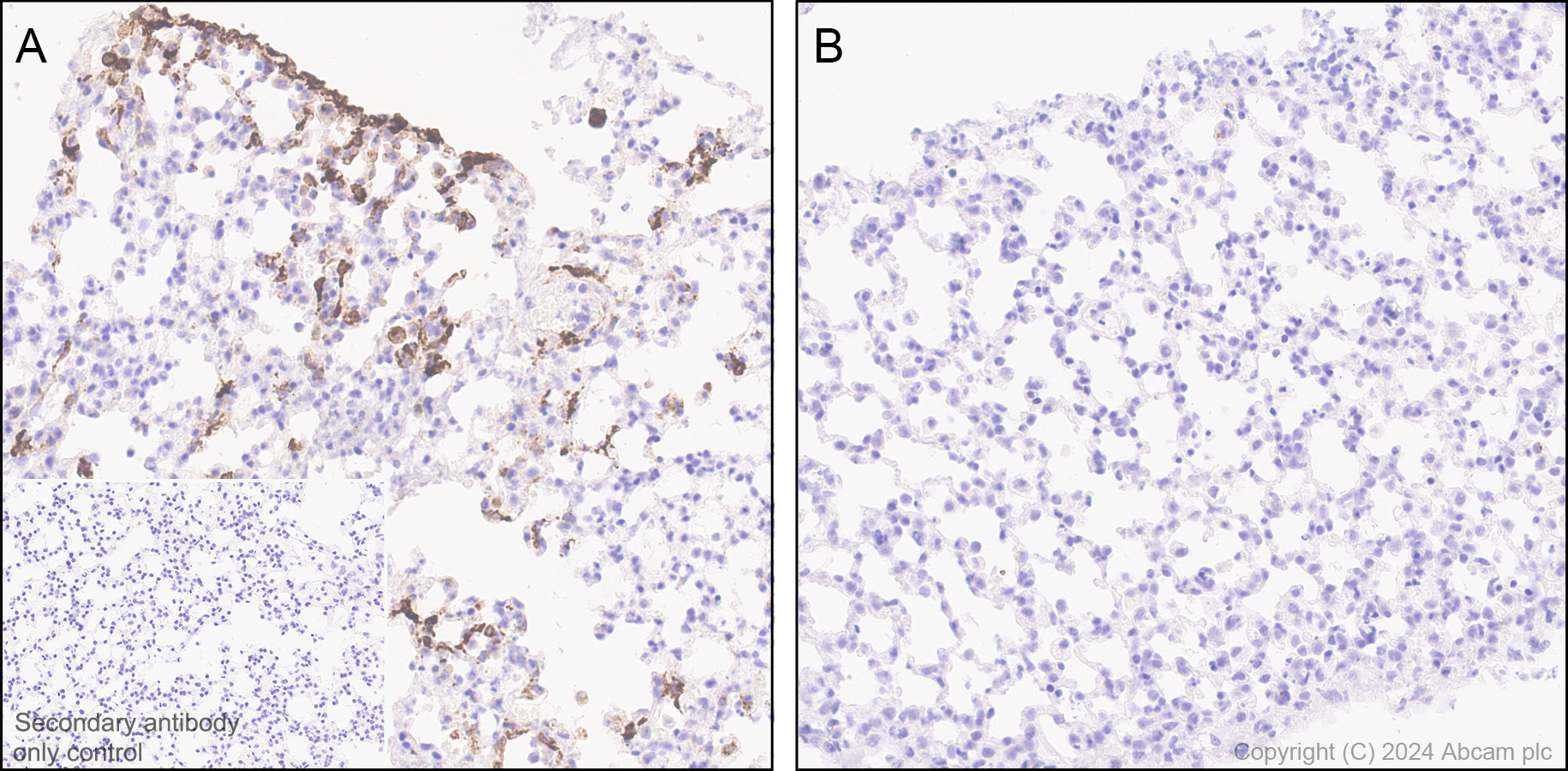 Immunohistochemistry (Formalin/PFA-fixed paraffin-embedded sections) - Anti-CXCL2 antibody [EPR28746-89] (AB317569), expandable thumbnail