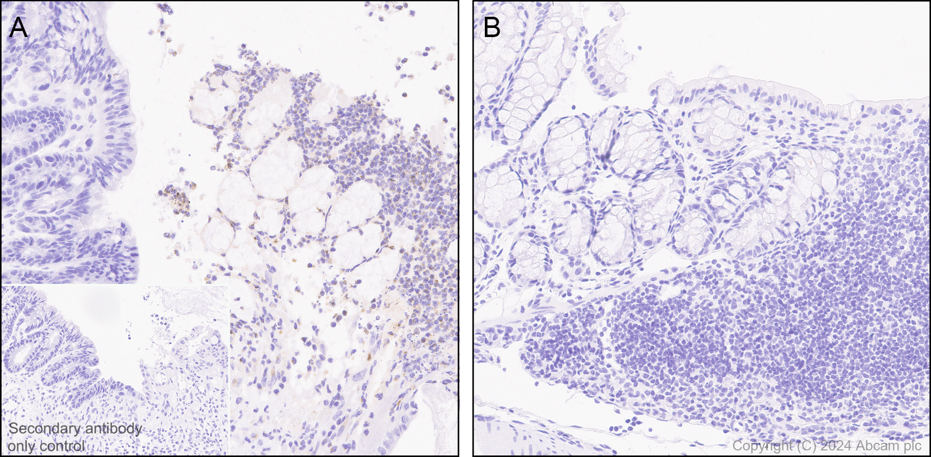 Immunohistochemistry (Formalin/PFA-fixed paraffin-embedded sections) - Anti-CXCL2 antibody [EPR28746-89] (AB317569), expandable thumbnail