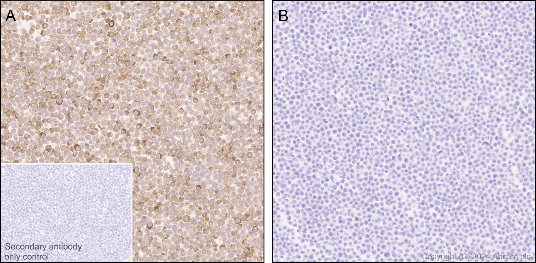 Immunohistochemistry (Formalin/PFA-fixed paraffin-embedded sections) - Anti-CXCL2 antibody [EPR28746-89] (AB317569), expandable thumbnail