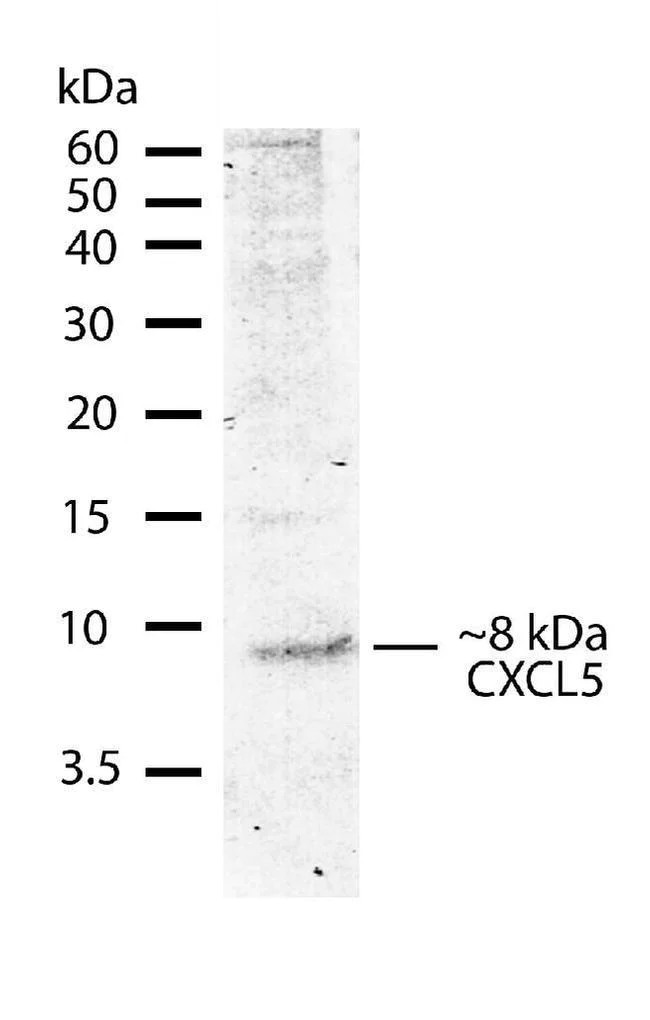 Western blot - Anti-CXCL5 antibody [RP23040004] (AB308023)
