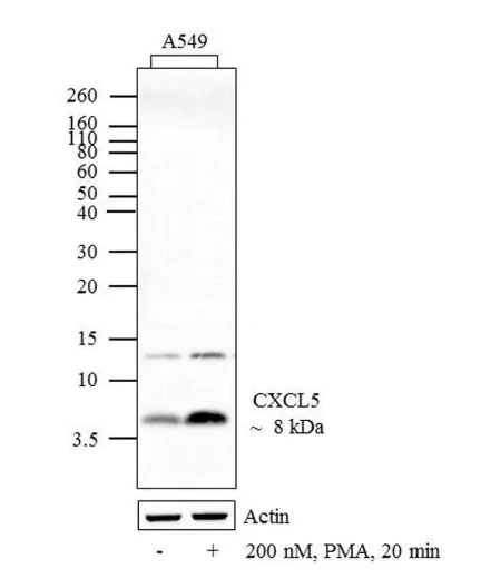 Western blot - Anti-CXCL5 antibody [RP23040004] (AB308023)
