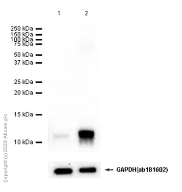 Western blot - Anti-CXCL5 + CXCL6 antibody [EP13083] - BSA and Azide free (AB284855)