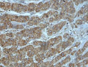 Immunohistochemistry (Formalin/PFA-fixed paraffin-embedded sections) - Anti-CXCL7/PBP antibody (AB169946)