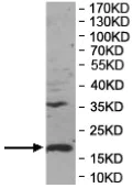 Western blot - Anti-CXCL7/PBP antibody (AB169946)