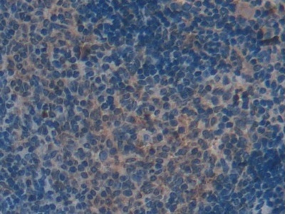 Immunohistochemistry (Formalin/PFA-fixed paraffin-embedded sections) - Anti-CXCL7/PBP antibody (ab231102), expandable thumbnail