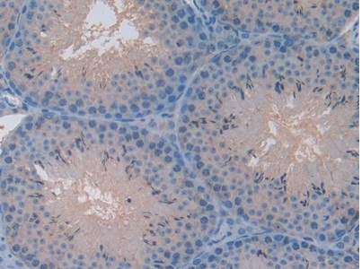 Immunohistochemistry (Formalin/PFA-fixed paraffin-embedded sections) - Anti-CXCL7/PBP antibody (ab231102), expandable thumbnail