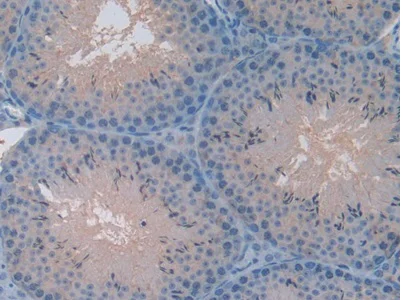 Immunohistochemistry (Formalin/PFA-fixed paraffin-embedded sections) - Anti-CXCL7/PBP antibody (AB231102)