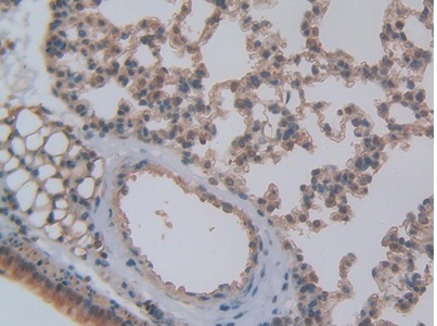 Immunohistochemistry (Formalin/PFA-fixed paraffin-embedded sections) - Anti-CXCL7/PBP antibody (AB231102), expandable thumbnail