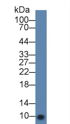 Western blot - Anti-CXCL7/PBP antibody (AB231102)