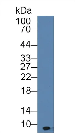 Western blot - Anti-CXCL7/PBP antibody (AB231102)